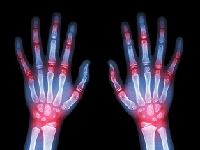 Робот исключит ошибки и сэкономит время врача